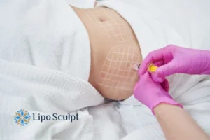 Are The Results From Aqualyx Permanent? 1 Do you want to know how long Aqualyx Bishop's Stortford results last?