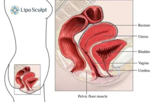 Treatment For A Leaky Bladder 2 How EM Chair treatment Bishop's Stortford can help Leaky bladder issues. Read more now!