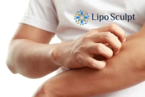 Best Actinic Keratoses Removal 4 prevent your actinic keratoses Bishop's Stortford getting worse - call our team today!