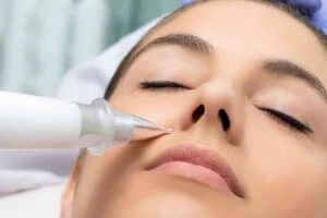 Best Actinic Keratoses Removal 3 Actinic keratoses Bishop's Stortford solutions - book in today!